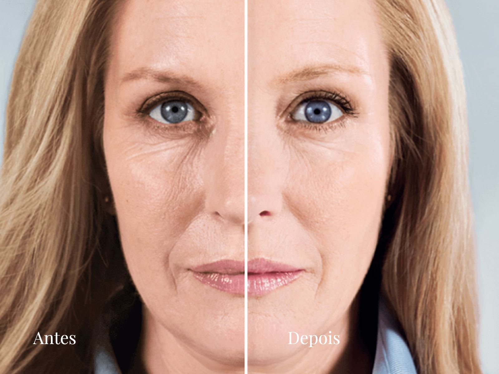 Imagem editorial relacionada a procedimentos faciais